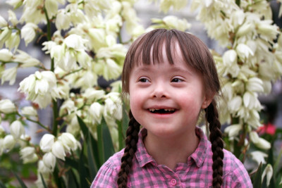 Ini Pertanyaan yang Sering Diajukan Mengenai Down Syndrome